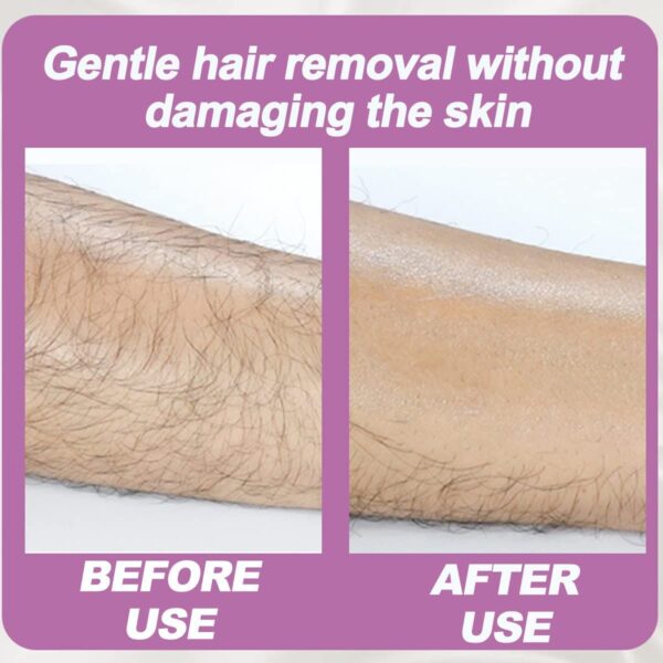 ⁦Crystal Hair Removal⁩ - الصورة ⁦4⁩